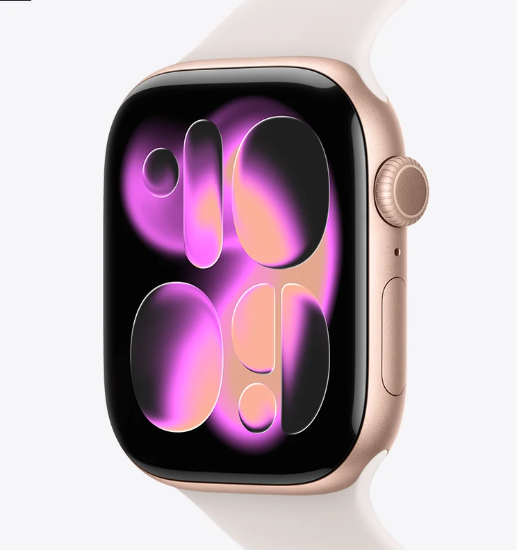 Apple Watch Series 11 dourado com pulseira estelar